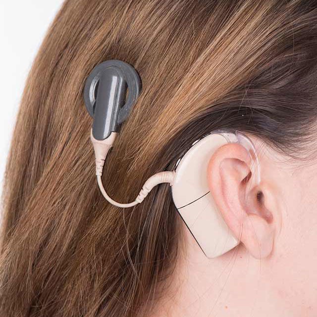 cochlear impant new